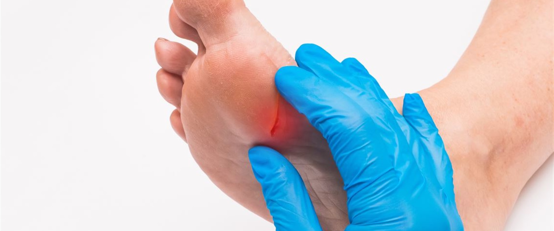 the-importance-of-proper-wound-care-expert-insights-and-advancements