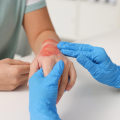 Antibiotics for Wound Infection: Risks, Options, and Healing Advice
