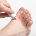 Antifungal Infection Cream Ingredients & Application Tips
