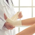 Unna Boot Application: Heal Leg Ulcers Faster With This Proven Method