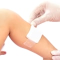 Is Transparent Film Dressing the Key to Faster Healing? Discover How It Protects and Heals Your Skin
