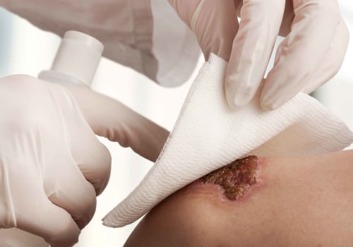 Identify Granulation Tissue vs Slough in Wound Healing
