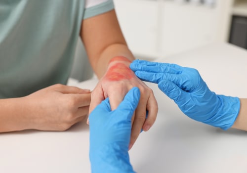 Antibiotics for Wound Infection: Risks, Options, and Healing Advice