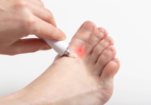 Antifungal Infection Cream Ingredients & Application Tips