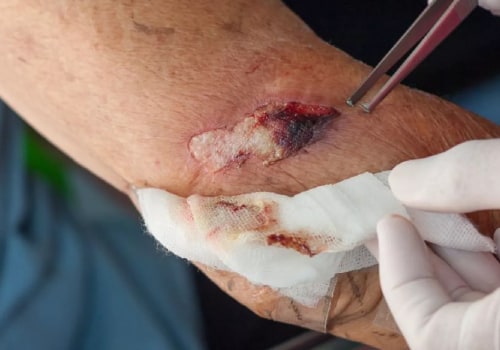 Serosanguineous Drainage Guide: Causes, Color, and Care Tips