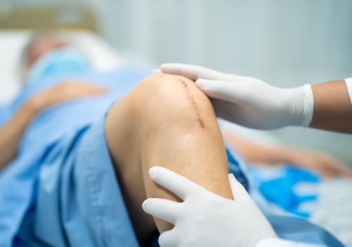Do Stitches Hurt When Healing? Proven Ways to Soothe Pain and Heal Faster