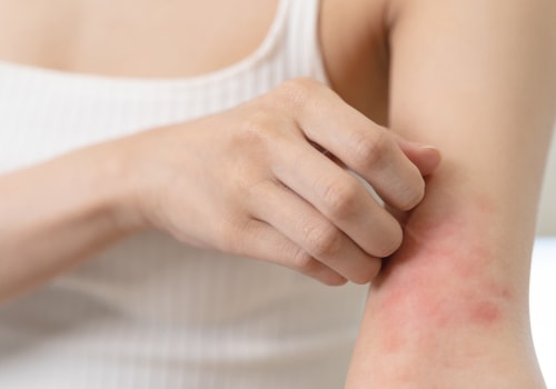 Is Itching a Sign of Healing? Here’s What Your Body Might Be Trying to Tell You During Recovery
